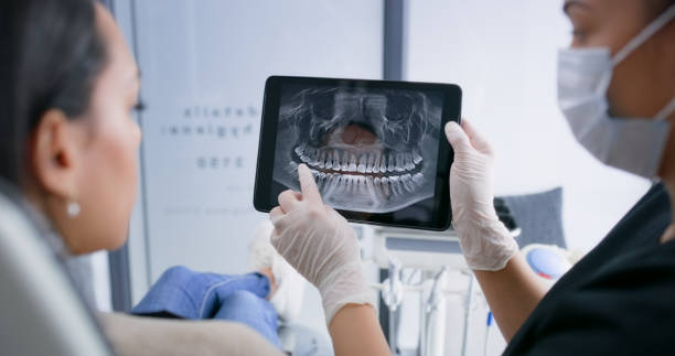 Licensed Wisdom Tooth Removal service in Union, MS - Smile Center Dentistry